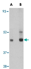 PAB13006 - PAFAH1B1 / LIS1