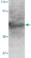 PAB13007 - STEAP2 / STAMP1