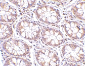 PAB13007 - STEAP2 / STAMP1