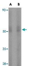 PAB13008 - STEAP3 / TSAP6