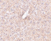 PAB13008 - STEAP3 / TSAP6