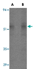 PAB13009 - STEAP4