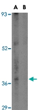 PAB13010 - CCDC98