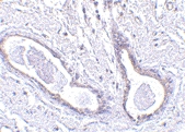 PAB13010 - CCDC98