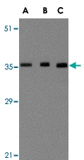 PAB13012 - BRCC3