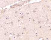 PAB13012 - BRCC3