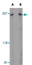 PAB13013 - ARHGEF17 / TEM4