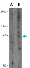 PAB13015 - GRIK3 / GLUR7