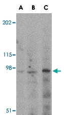 PAB13016 - Glutamate receptor KA2 / GRIK5