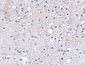 PAB13016 - Glutamate receptor KA2 / GRIK5