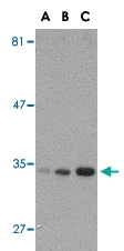 PAB13017 - APG10L / ATG10