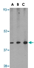 PAB13018 - ZBP1