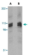 PAB13019 - DLGAP3