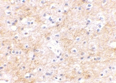 PAB13019 - DLGAP3