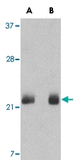 PAB13022 - FGF4