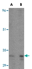 PAB13023 - APG5L / ATG5