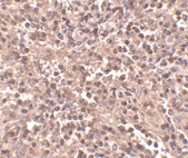 PAB13023 - APG5L / ATG5