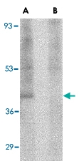 PAB13025 - RIMS3