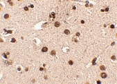 PAB13025 - RIMS3