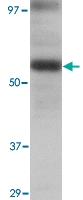 PAB13026 - LGI3