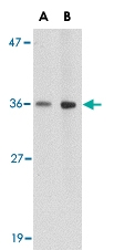 PAB13027 - Brain link protein 1 / BRAL1