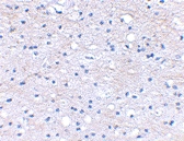 PAB13027 - Brain link protein 1 / BRAL1