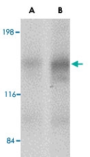 PAB13030 - CADPS2 / CAPS2