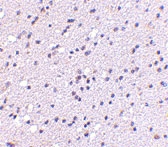 PAB13030 - CADPS2 / CAPS2