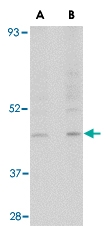 PAB13031 - RGP1