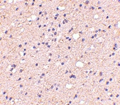 PAB13032 - ELOVL6