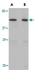 PAB13033 - Neuronal pentraxin-2