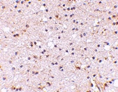 PAB13033 - Neuronal pentraxin-2