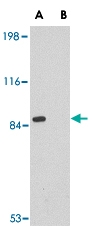 PAB13035 - RIMS2