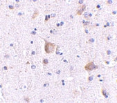 PAB13035 - RIMS2