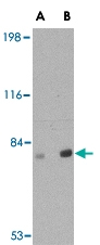 PAB13036 - VGF