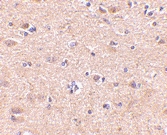 PAB13036 - VGF