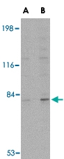 PAB13037 - GPAM / GPAT1