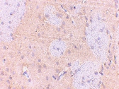 PAB13037 - GPAM / GPAT1