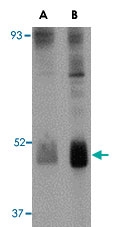 PAB13039 - WNT10B