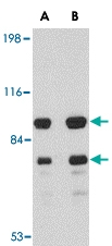 PAB13040 - DLGAP1 / SAPAP1