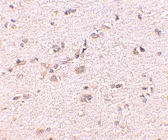PAB13040 - DLGAP1 / SAPAP1