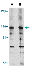 PAB13041 - DLGAP2