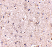 PAB13041 - DLGAP2