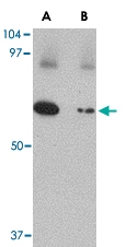 PAB13044 - SLC22A17