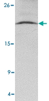 PAB13045 - NANOS3