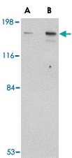 PAB13046 - CLIP1 / Restin