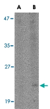 PAB13047 - CD317 / BST2