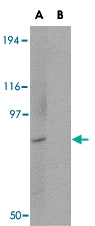 PAB13048 - BICD1