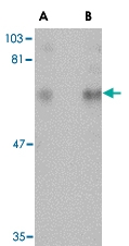 PAB13049 - CPEB1