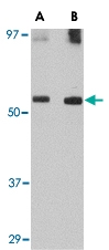 PAB13050 - BMP13 / GDF6